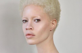 Diandra Forrest