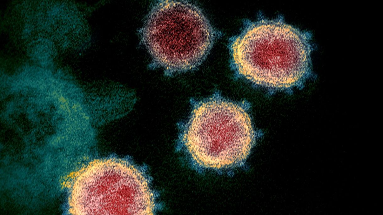 The microscopic view of the virus which causes Coronavirus disease.