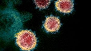 The microscopic view of the virus which causes Coronavirus disease.