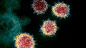 The microscopic view of the virus which causes Coronavirus disease.
